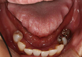 �C���v�����g���ÑO