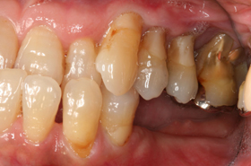 �C���v�����g���ÑO