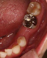 �C���v�����g���ÑO